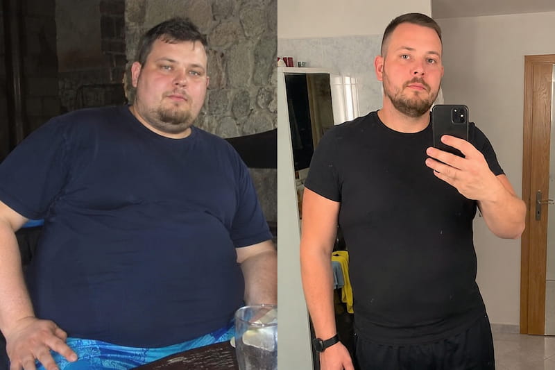 Mounjaro injekce na hubnutí - před hubnutím a po hubnutí